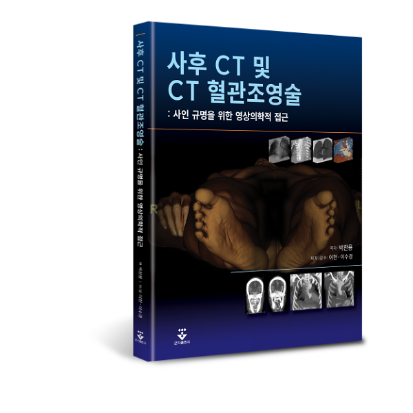 입체표지(3D 표지)